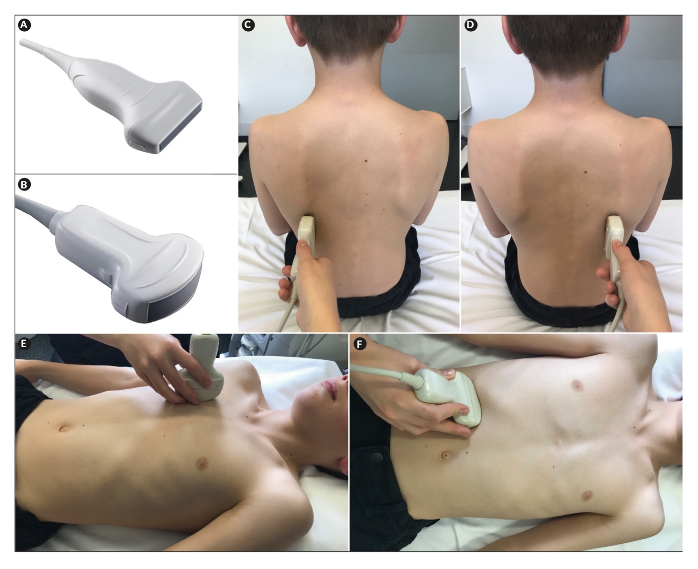 Thoracic Sonography An Overview Published In Healthbook TIMES 